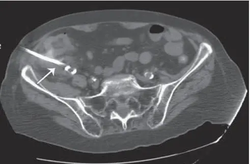 اقدامات مداخله ای